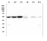 Anti-Desmin Antibody Picoband® (monoclonal, 2B5 Boster Bio