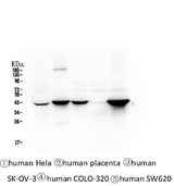 Anti-Cytokeratin 19 KRT19 Antibody Picoband® (monoclonal, 3D4 Boster Bio