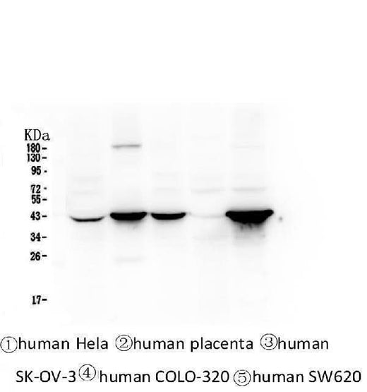 Anti-Cytokeratin 19 KRT19 Antibody Picoband® (monoclonal, 3D4 Boster Bio