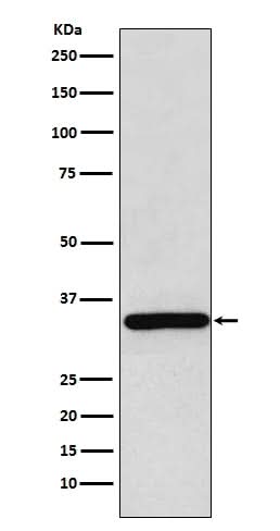 Anti-gamma Sarcoglycan Rabbit Monoclonal Antibody Boster Bio