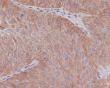 Anti-alpha Tubulin TUBA1B Rabbit Monoclonal Antibody Boster Bio