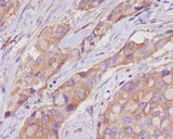 Anti-alpha Tubulin TUBA1B Rabbit Monoclonal Antibody Boster Bio