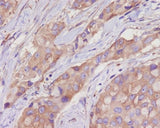 Anti-alpha Tubulin TUBA1B Rabbit Monoclonal Antibody Boster Bio