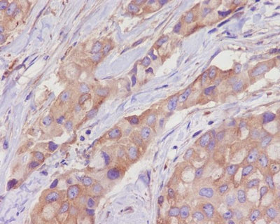 Anti-alpha Tubulin TUBA1B Rabbit Monoclonal Antibody Boster Bio