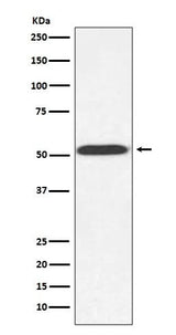 Anti-alpha Tubulin (yeast) TUB1 Rabbit Monoclonal Antibody Boster Bio