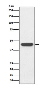 Anti-HA-Tag Rabbit Monoclonal Antibody Boster Bio