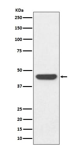 Anti-HA-Tag Rabbit Monoclonal Antibody Boster Bio