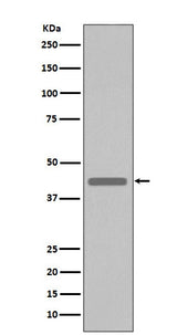 Anti-VSV-G-Tag Rabbit Monoclonal Antibody Boster Bio