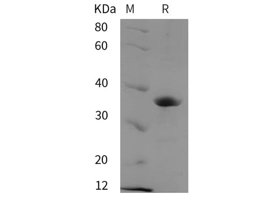 SDS-PAGE analysis of Human PACT proteins, 2 μg/lane of Recombinant Human PACT proteins was resolved with SDS-PAGE under reducing conditions, showing bands at 38 kDa.