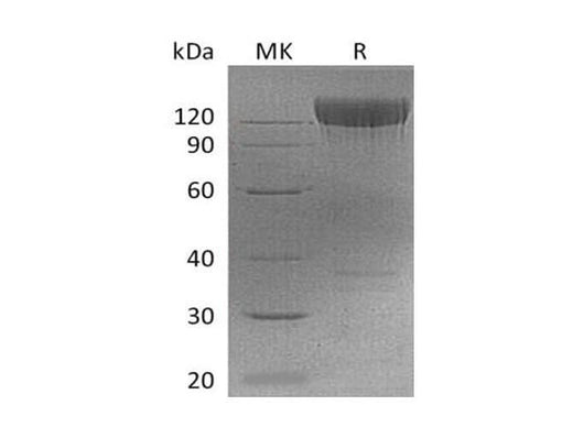 Recombinant Mouse PDGFRa/CD140a Protein (Fc Tag) - ABMIUM