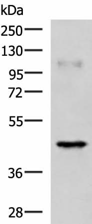 Western blot analysis of Human muscle tissue lysate using RAB3IL1 Polyclonal Antibody at dilution of 1:1000