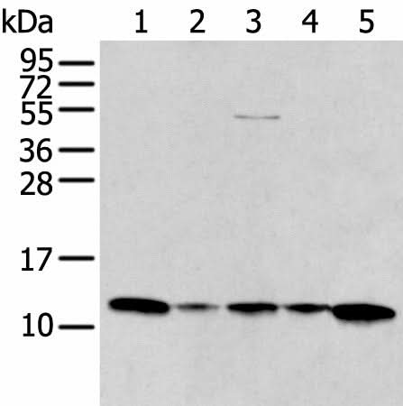 Western blot analysis of A431 Jurkat Lovo and Hepg2 cell Human breast cancer tissue lysates using CCL1 Polyclonal Antibody at dilution of 1:400