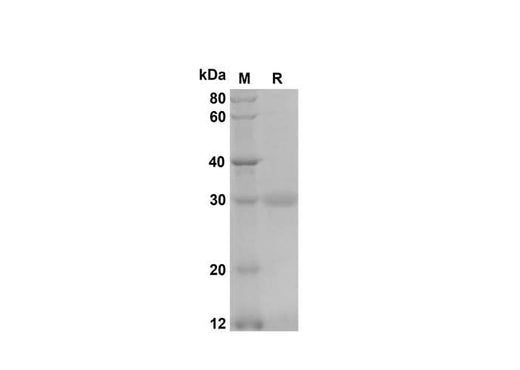 SDS-PAGE analysis of Mouse CXCL3/CINC-2α/β proteins, 2 μg/lane of Recombinant Mouse CXCL3/CINC-2α/β proteins was resolved with SDS-PAGE under reducing conditions, showing bands at 30 kDa.
