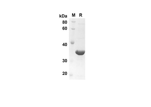 SDS-PAGE analysis of Human FGF6 proteins, 2 μg/lane of Recombinant Human FGF6 proteins was resolved with SDS-PAGE under reducing conditions, showing bands at 38.5 kDa.