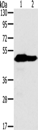 Anti-Human/Mouse NDUFV1 Antibody - ABMIUM