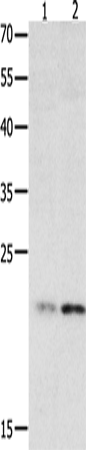 Anti-Human HMGB4 Antibody - ABMIUM