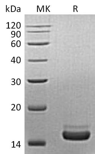Recombinant Mouse PLA2G1B/PLA2 Protein (His Tag) - ABMIUM