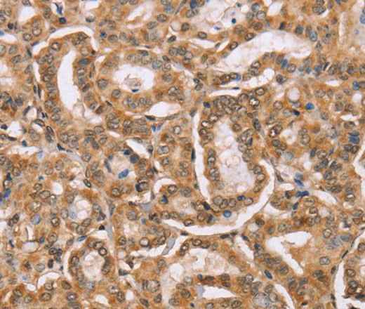Anti-Human BGLAP Antibody