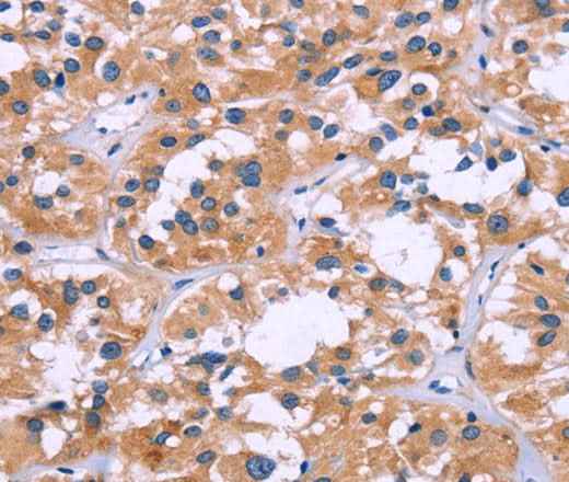 Anti-Human/Mouse ZEB2 Antibody