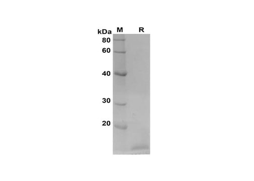 SDS-PAGE analysis of Rat IGF proteins, 2 μg/lane of Recombinant Rat IGF proteins was resolved with SDS-PAGE under reducing conditions, showing bands at 15 kDa.
