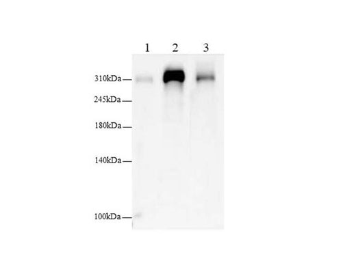 Anti-Human/Mouse/Rat FLNC Antibody - ABMIUM