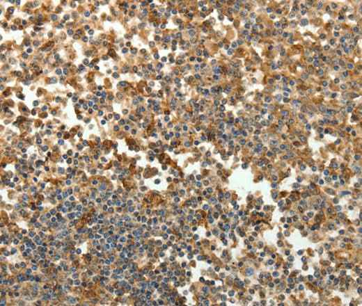 Anti-Human SFTPD Antibody