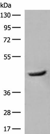 Western blot analysis of Human fetal liver tissue lysate using GCAT Polyclonal Antibody at dilution of 1:400