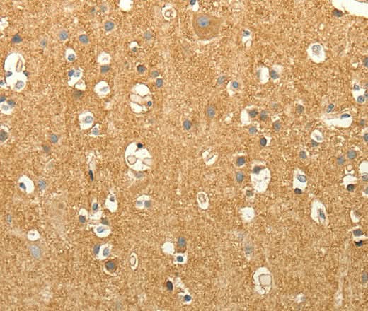 Anti-Human/Mouse/Rat EDG7 Antibody - ABMIUM