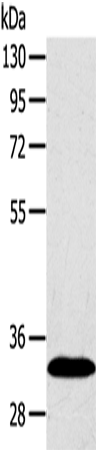 Anti-Human SULT2A1 Antibody - ABMIUM