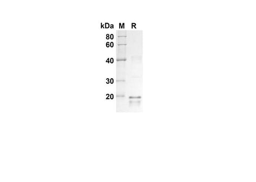 SDS-PAGE analysis of Human TNFRSF17 proteins, 2 μg/lane of Recombinant Human TNFRSF17 proteins was resolved with SDS-PAGE under reducing conditions, showing bands at 18.8 kDa.