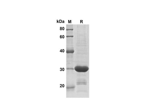 SDS-PAGE analysis of Human ACSL4 proteins, 2 μg/lane of Recombinant Human ACSL4 proteins was resolved with SDS-PAGE under reducing conditions, showing bands at 30 kDa.