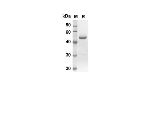 SDS-PAGE analysis of Human STAR proteins, 2 μg/lane of Recombinant Human STAR proteins was resolved with SDS-PAGE under reducing conditions, showing bands at 44.2 kDa.