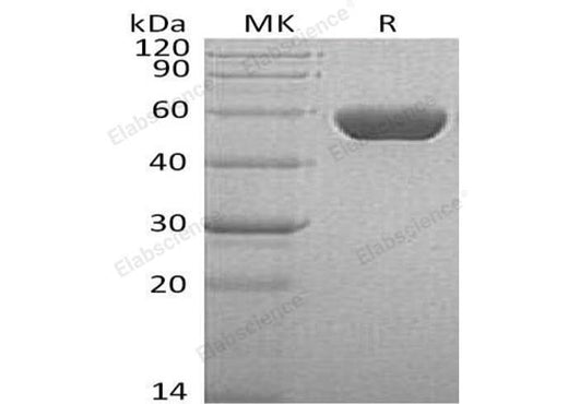 Recombinant Human SerpinA1/A1AT Protein (His Tag) - ABMIUM