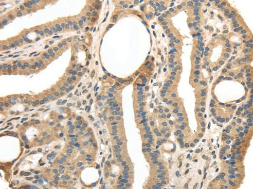 Anti-Human TRIB3 Antibody - ABMIUM