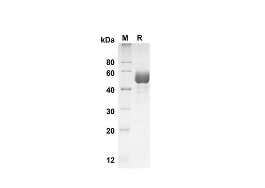 SDS-PAGE analysis of Human SCF/c-kit Ligand proteins , 2 μg/lane of Recombinant Human SCF/c-kit Ligand proteins was resolved with SDS-PAGE under reducing conditions , showing bands at 50 kDa.
