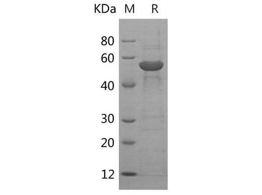 SDS-PAGE analysis of Human PBEF/NAMPT proteins, 2 μg/lane of Recombinant Human PBEF/NAMPT proteins was resolved with SDS-PAGE under reducing conditions, showing bands at 55 kDa.