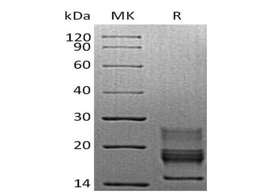 Recombinant Mouse Interferon γ/IFNG Protein (His Tag) - ABMIUM