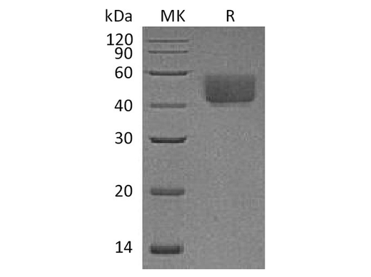 Recombinant Rat PD-L1/B7-H1/CD274 Protein (C-His) - ABMIUM