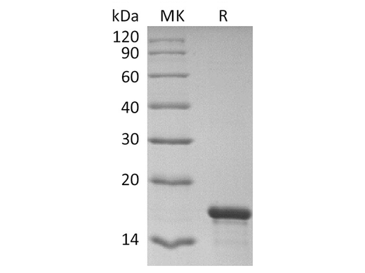 Recombinant SARS-CoV-2 NP NTD domain (His Tag) - ABMIUM