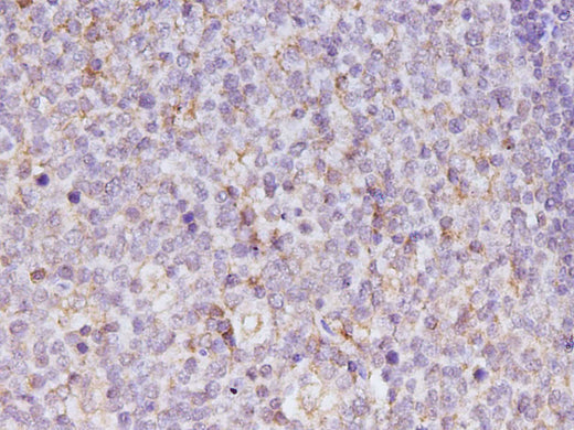 Anti-Human IL-17A Antibody - ABMIUM