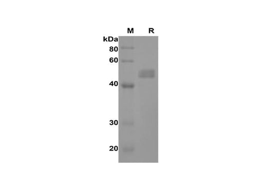 SDS-PAGE analysis of Rat IL-17A proteins,2 μg/lane of Recombinant Rat IL-17A proteins,was resolved with SDS-PAGE under reducing conditions,showing bands at 45-50 kDa.