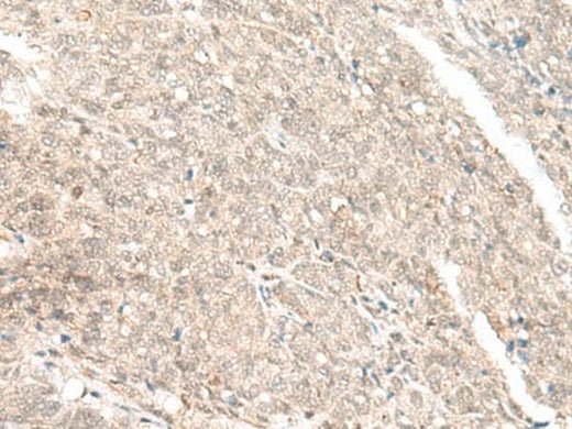 Anti-Human GANC Antibody - ABMIUM