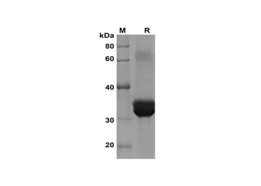 SDS-PAGE analysis of Mouse PDGF-BB proteins, 2 μg/lane of Recombinant Mouse PDGF-BB proteins was resolved with SDS-PAGE under reducing conditions, showing bands at 33 kDa.