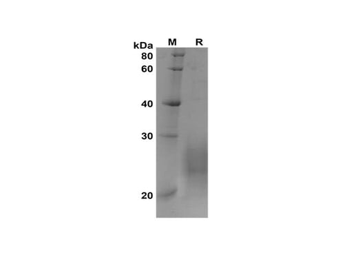 SDS-PAGE analysis of Rat IL-5 proteins, 2 μg/lane of Recombinant Rat IL-5 proteins was resolved with SDS-PAGE under reducing conditions, showing bands at 20-28 kDa.