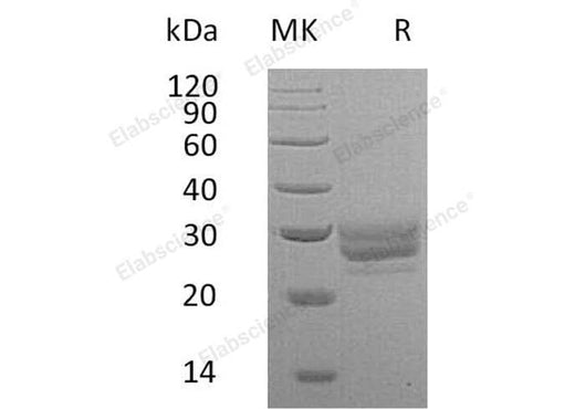 Recombinant Mouse FLT3LG/Flt3 Ligand Protein (His Tag) - ABMIUM