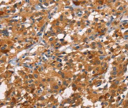 Anti-Human CDC25B Antibody