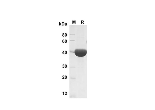 SDS-PAGE analysis of Mouse Chitinase 3-like 1 proteins , 2 μg/lane of Recombinant Mouse Chitinase 3-like 1 proteins was resolved with SDS-PAGE under reducing conditions , showing bands at 40 kDa.