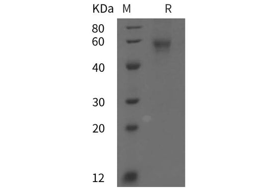 SDS-PAGE analysis of Mouse Il6RA/CD126 proteins, 2 μg/lane of Recombinant Mouse Il6RA/CD126 proteins was resolved with SDS-PAGE under reducing conditions, showing bands at 58 kDa.