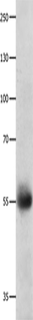 Anti-Human DRD5 Antibody - ABMIUM