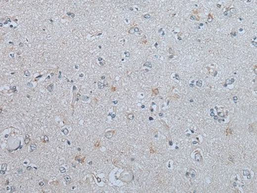 Immunohistochemistry of paraffin-embedded Human brain tissue using CENPF Polyclonal Antibody at dilution of 1:60(×200)